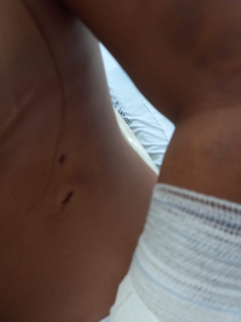 CASO MERIELE: Homem que agrediu brutalmente ex-mulher vai a julgamento hoje em Três Lagoas